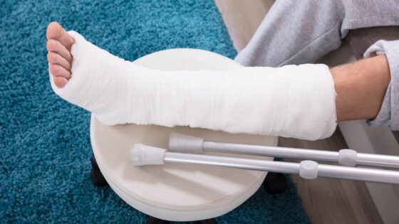 Síntomas y tratamiento del síndrome compartimental. Las causas más frecuentes están relacionadas con traumatismos, como fracturas, aplastamientos o contusiones severas.