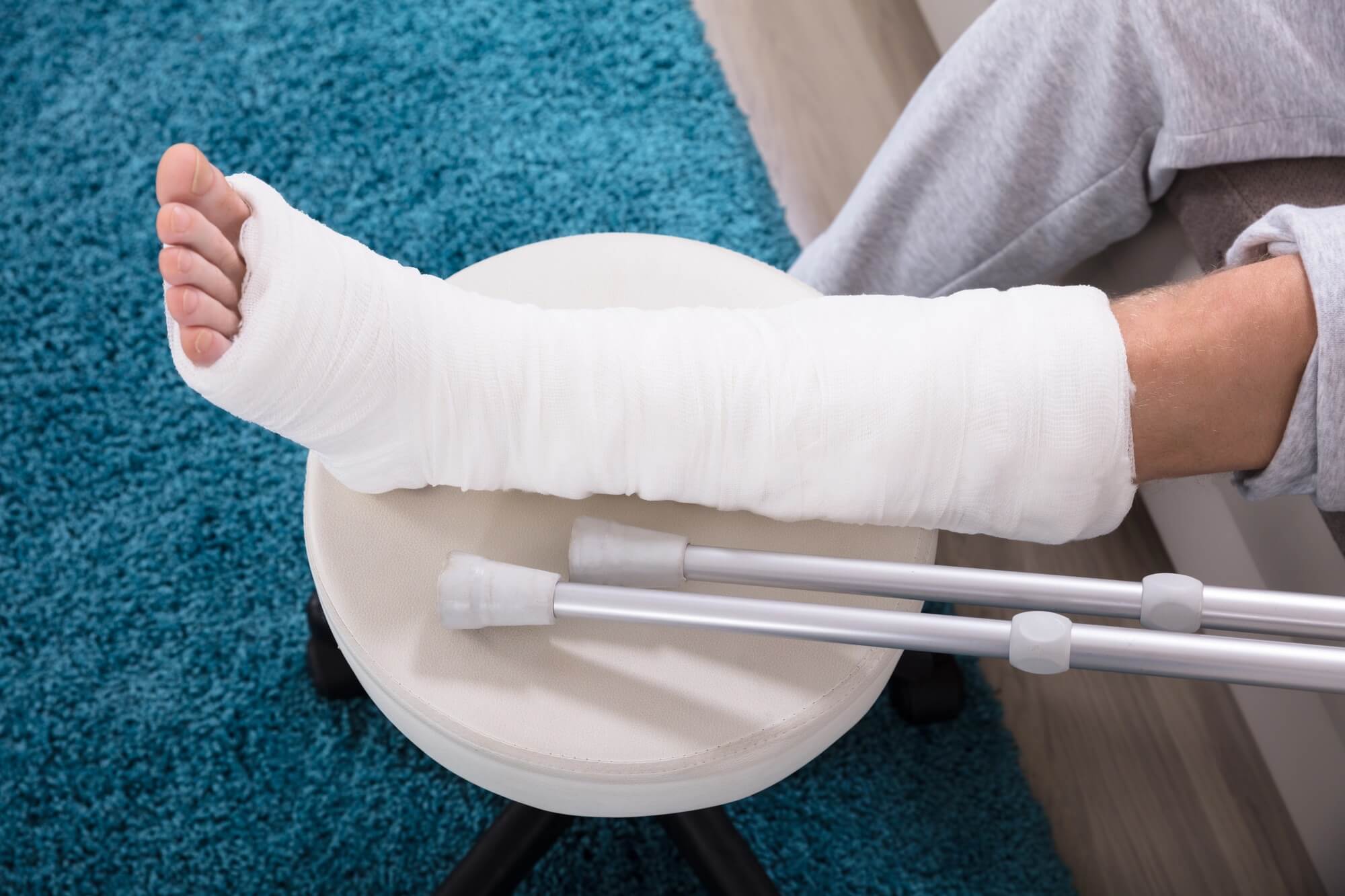Síntomas y tratamiento del síndrome compartimental. Las causas más frecuentes están relacionadas con traumatismos, como fracturas, aplastamientos o contusiones severas.
